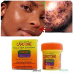 Carotone Black Spot Corrector B.S.C Cream 30ml | Hyper-Pigmentation & Acne Scar Treatment
