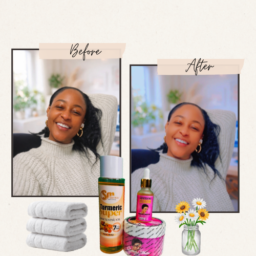 Strong Brightening & Lightening Body Set – Cream, Turmeric Oil & Vitamin C Serum | Even Skin Tone & Glow Boost - 3in1