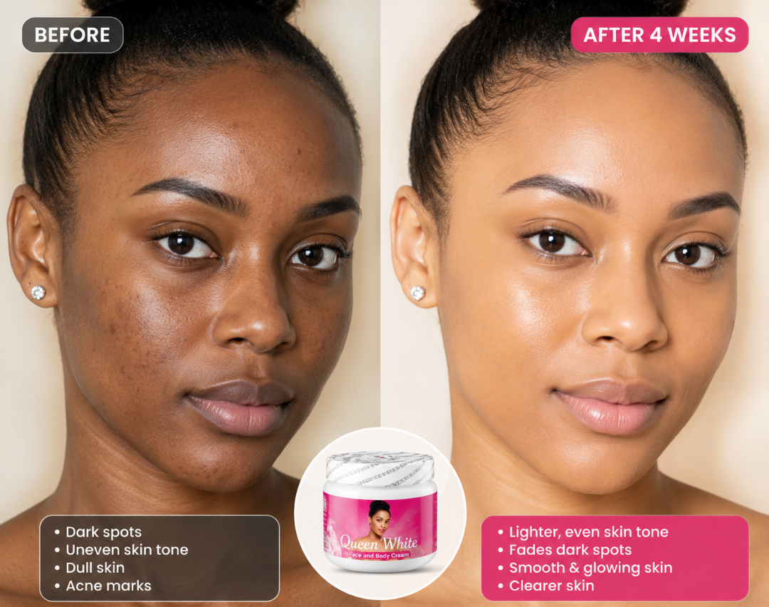 Strong Brightening & Lightening Body Cream – Even Skin Tone & Glow Boost
